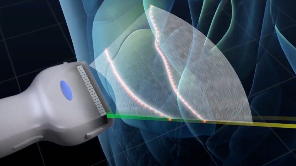 Dental Piezoelectric Ultrasonic Unit Market