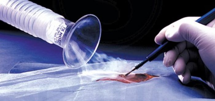 Electrosurgery Accessories Market