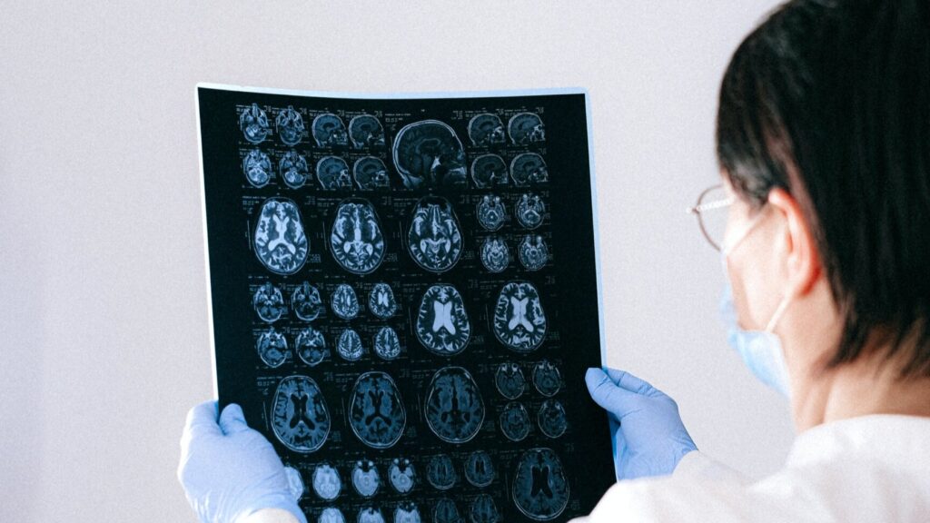 Frontotemporal Dementia Management Market