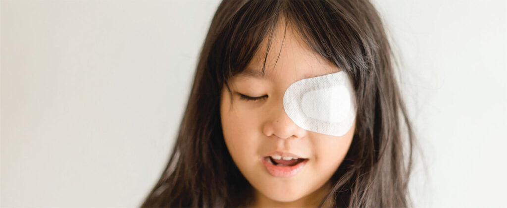 Global Amblyopia Treatment Market