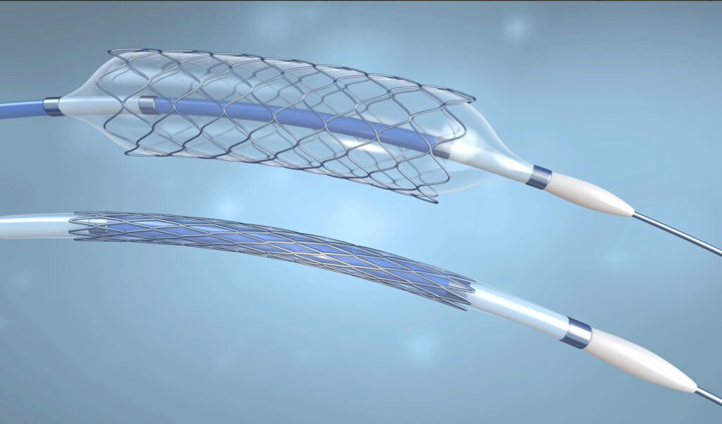 Global Dual Balloon Angioplasty Catheter Industry