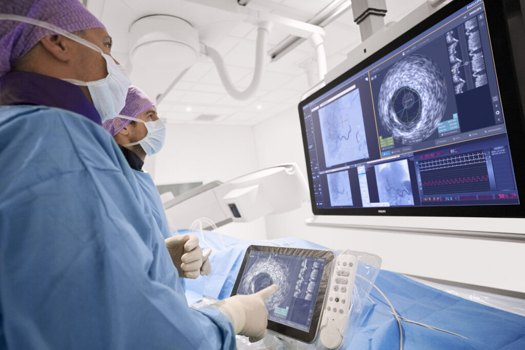  Intravascular Imaging Market