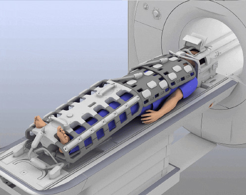 Magnetic Resonance Imaging Coils Market