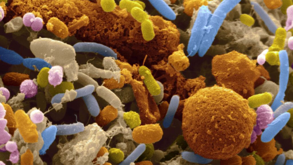 Microbial Lipase Market