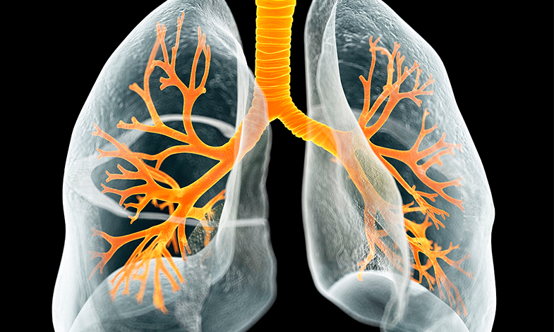 Pulmonary Fibrosis Biomarker Market