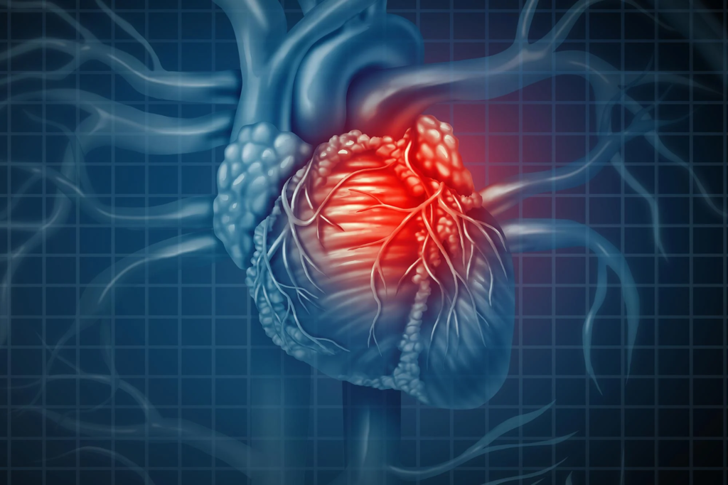 Restrictive Cardiomyopathy Treatment Market