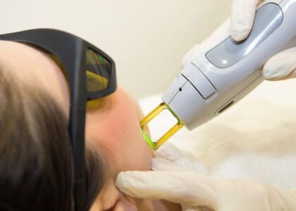 Laser Hair Removal Devices Market