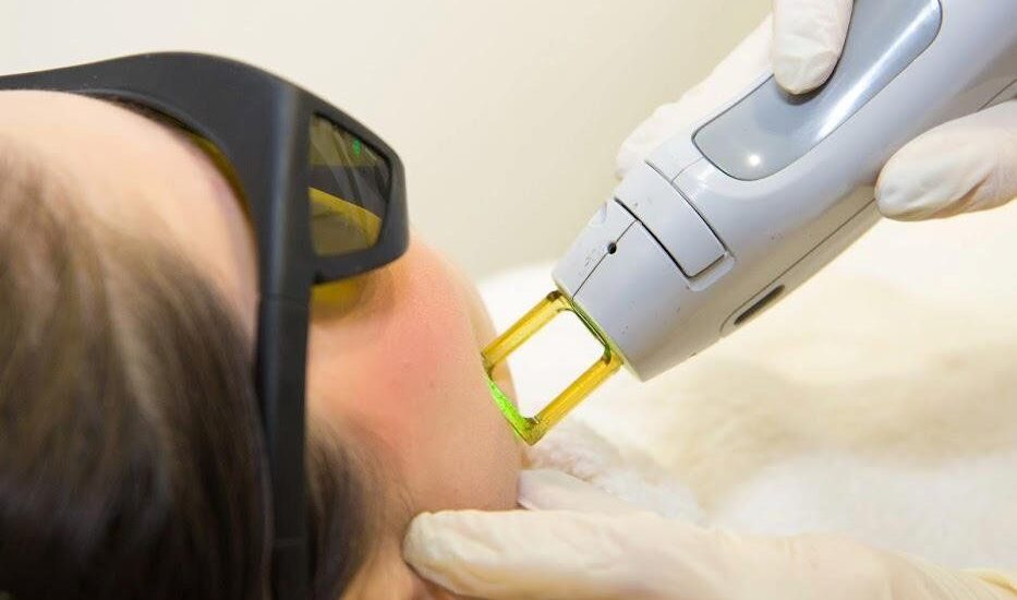 Laser Hair Removal Devices Market