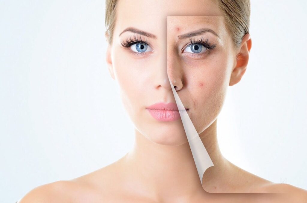 Skin Replacement Market Skin Replacement Market