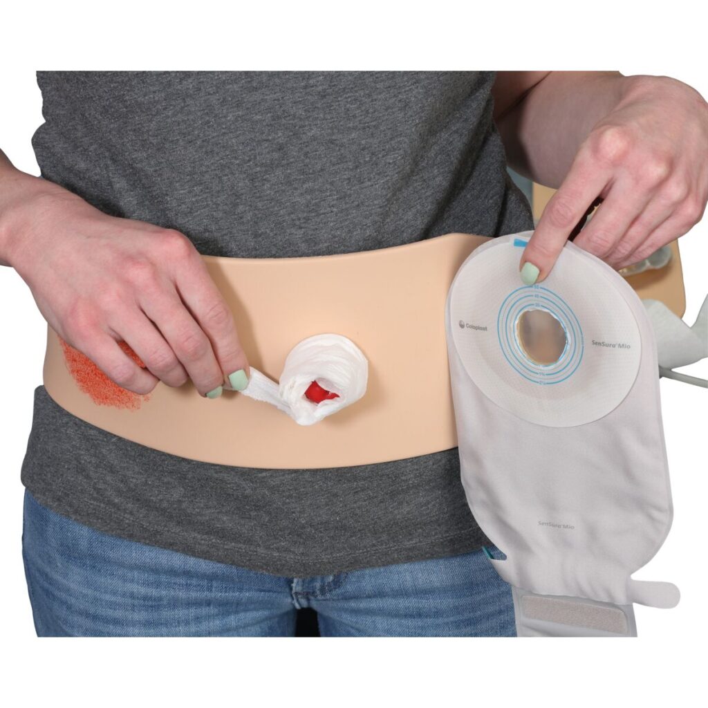 Stoma Ostomy Care Market Stoma Ostomy Care Market