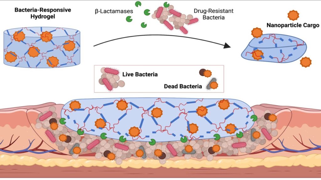 Hydrogel-Based Drug Delivery System Market