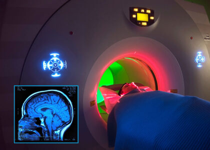 Magnetic Resonance Imaging (MRI) Contrast Agents Market