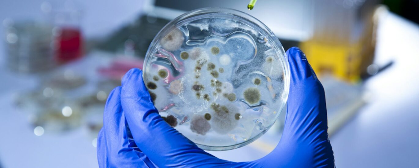 Microbial Identification Market