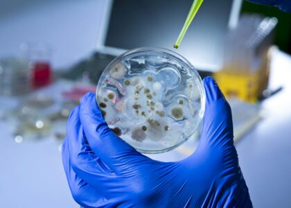 Microbial Identification Market