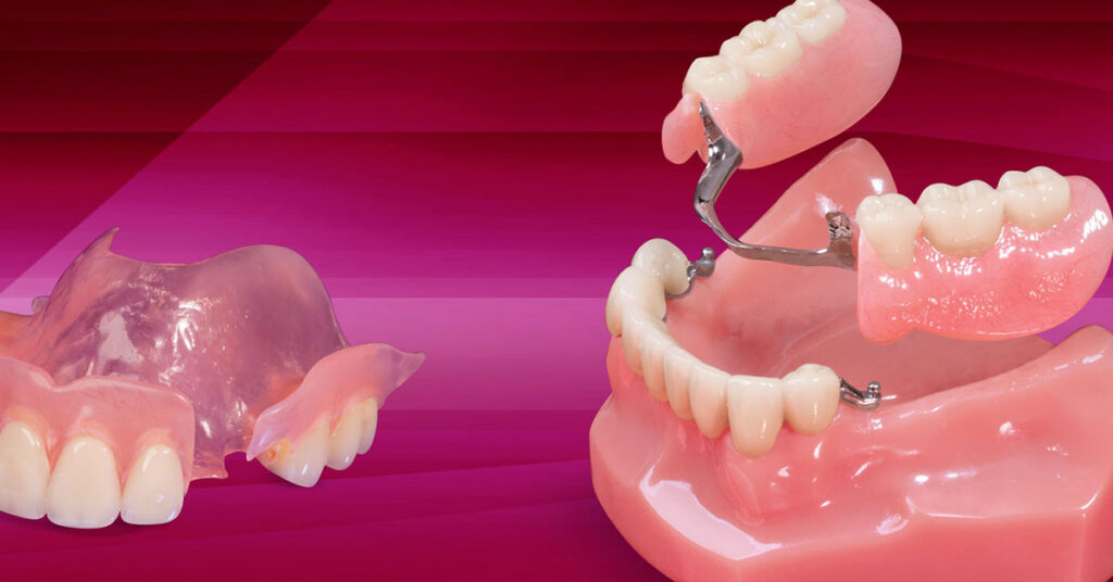 Global Dentures Market