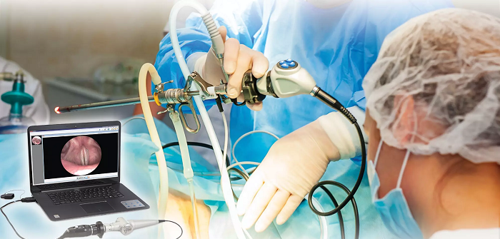 Continuous Peripheral Nerve Block Catheter Market
