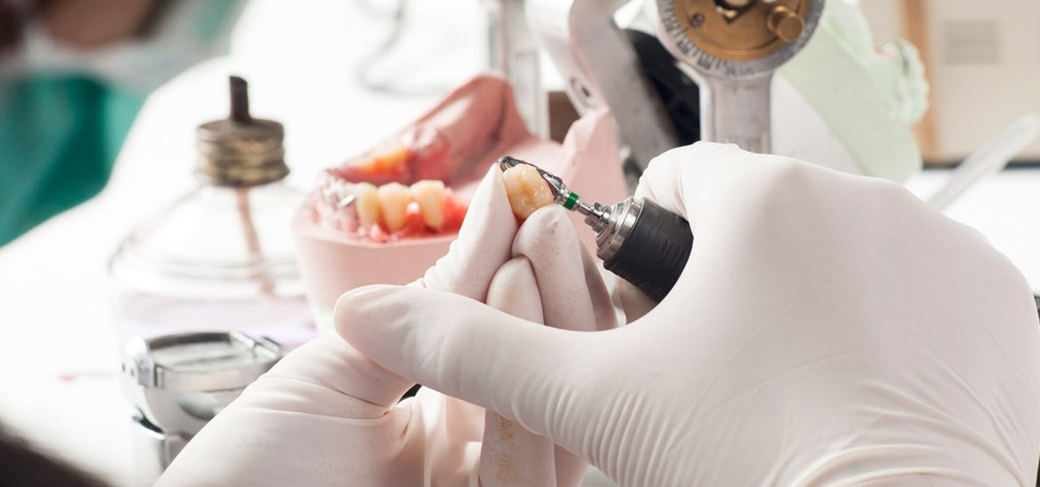 Dental Laboratory Market
