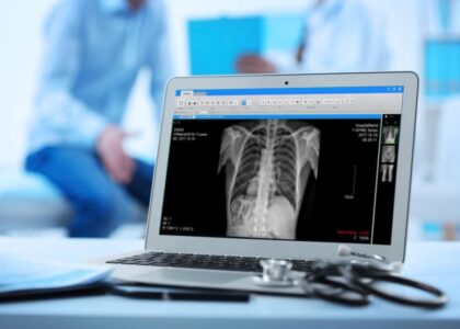 Global Digital Radiography Detectors Market
