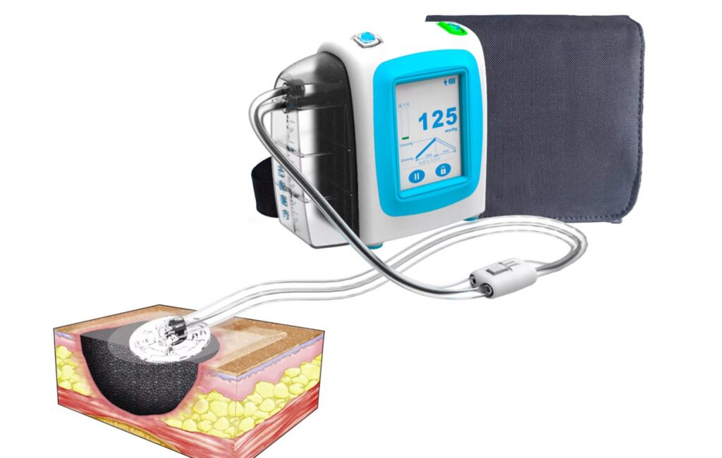 Disposable Negative Pressure Wound Therapy Devices Market Disposable Negative Pressure Wound Therapy Devices Market
