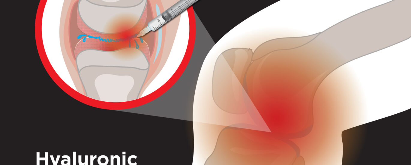 Knee Hyaluronic Acid Injections Market