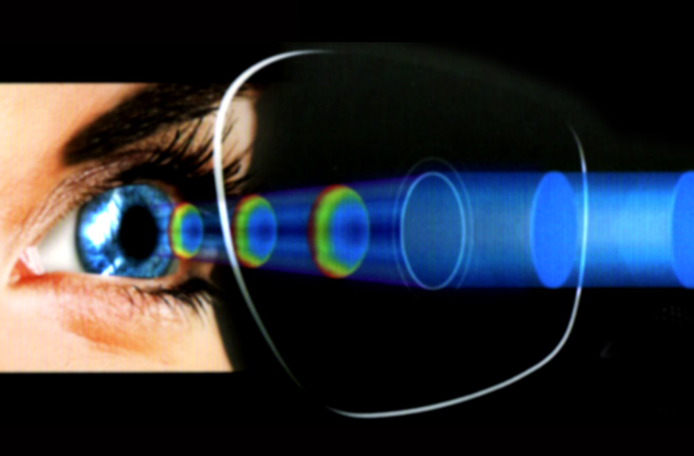 Spectacle Lens Market