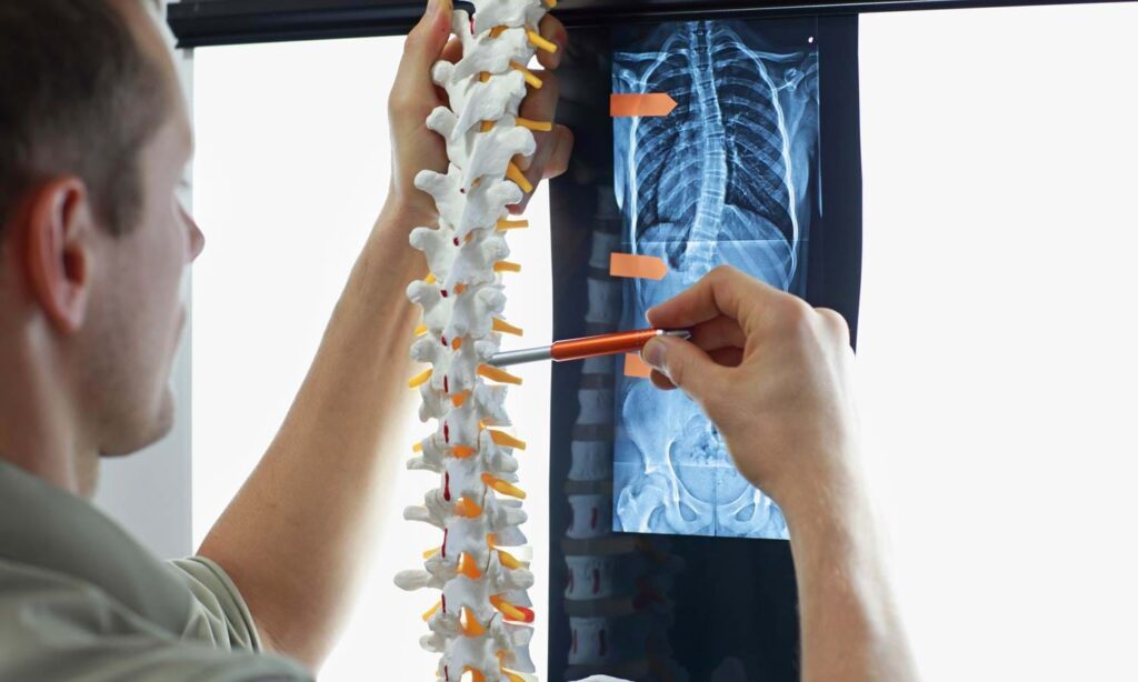 Spinal Osteosynthesis Units