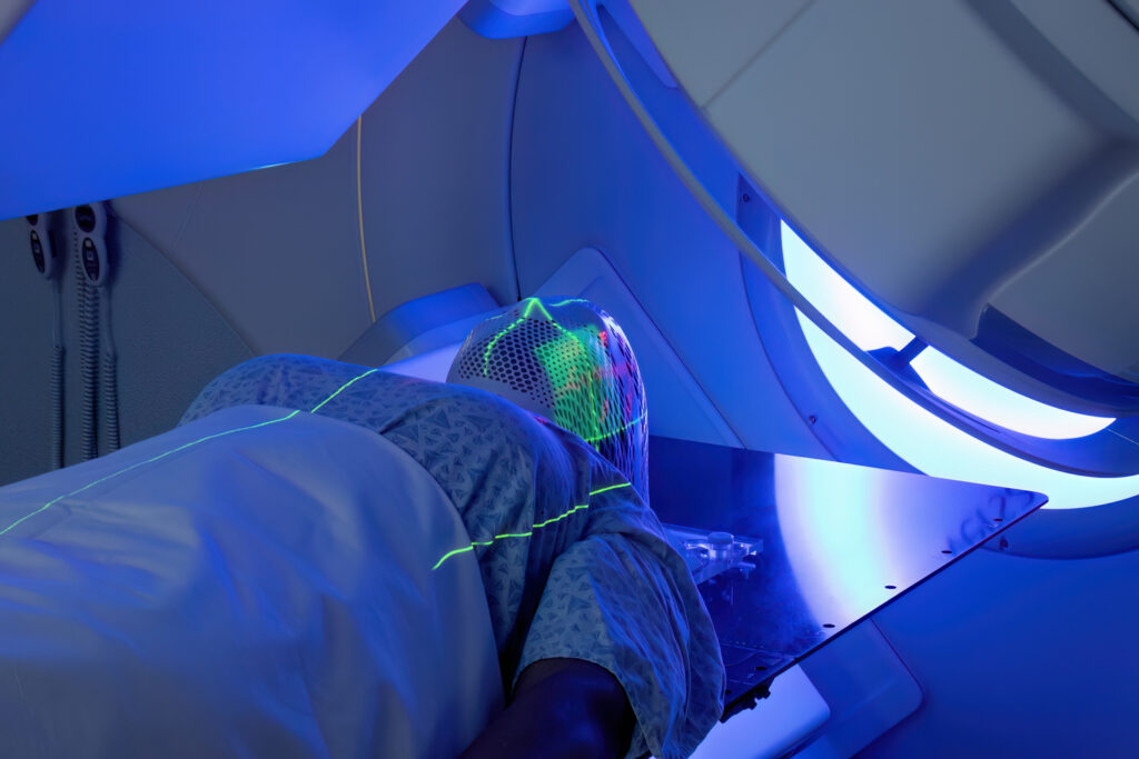 Stereotactic Radiation Therapy Market