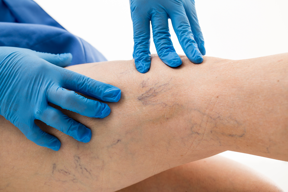 Vascular Boot market