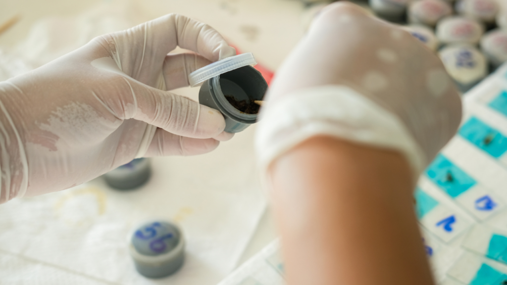 Calprotectin Testing Market