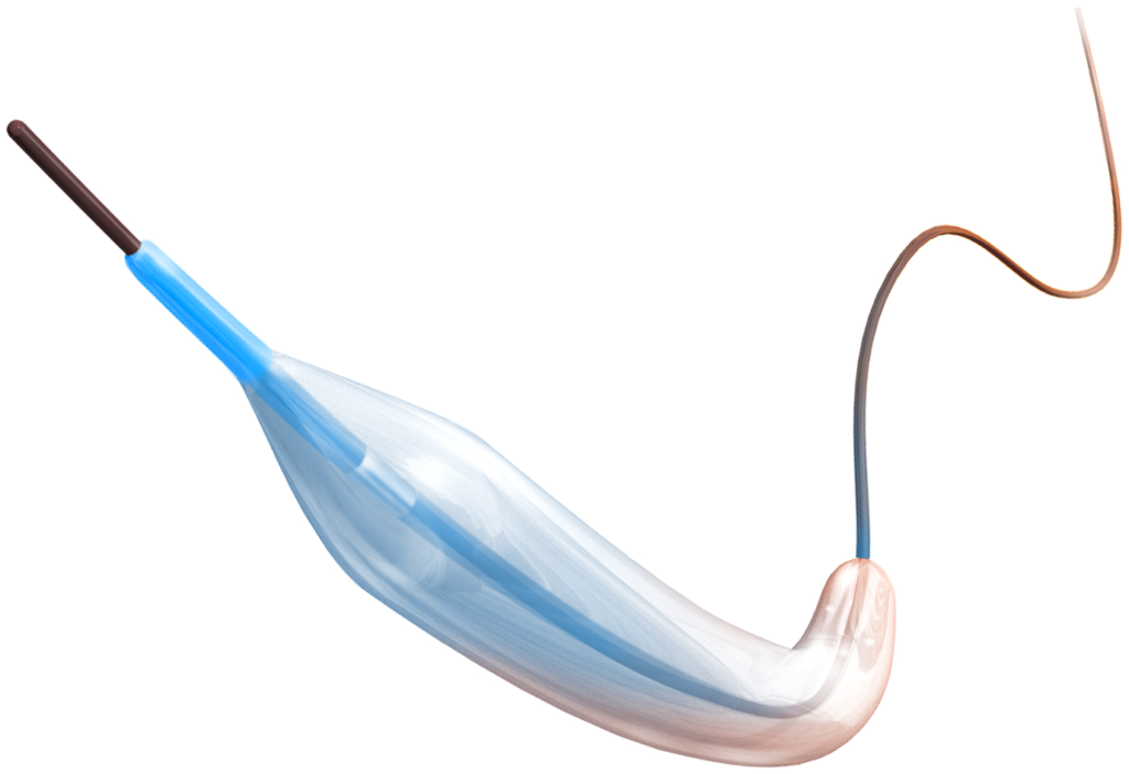 Micro Balloon Catheters Market