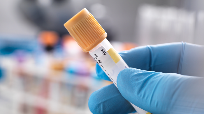 HIV Diagnostics Market