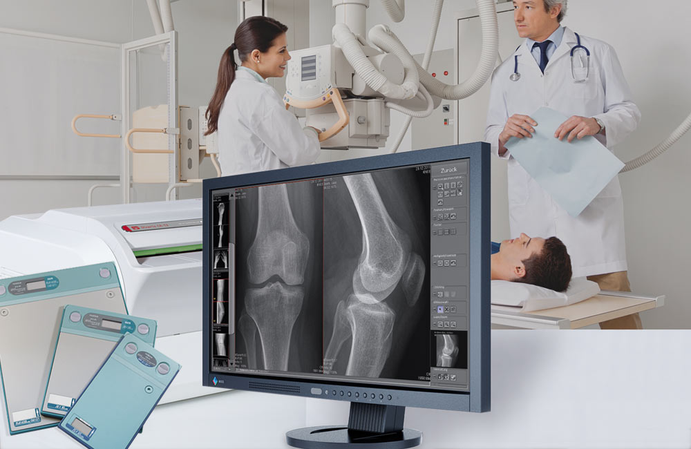 Digital Mobile X-Ray Devices Market