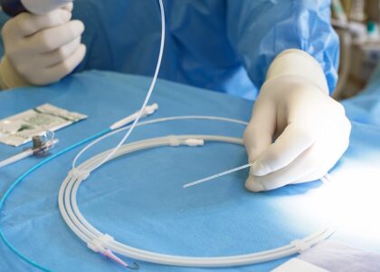 Global Neurovascular Guidewires Market