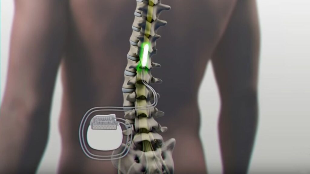 Spinal Devices Market