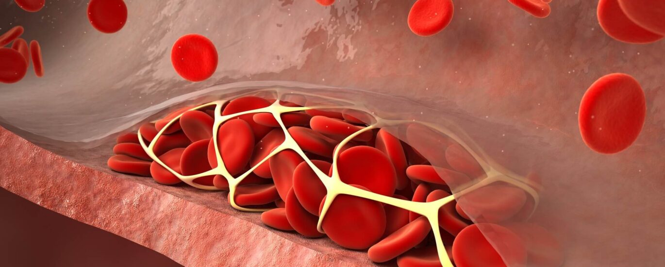 Venous Thromboembolism Treatment Market
