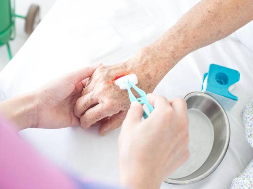 Wound Wash Market