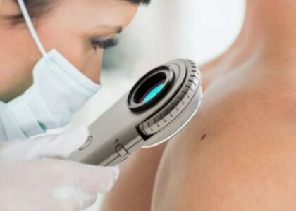 Dermatology Devices Market