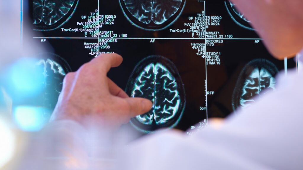 Global Neurology Services Market Poised for Remarkable Growth, Projected to Reach USD 4,524.3 Million by 2033, Surge at a 5.3% CAGR