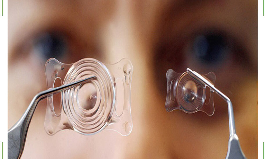 Phakic Intraocular Lenses (IOL) Market