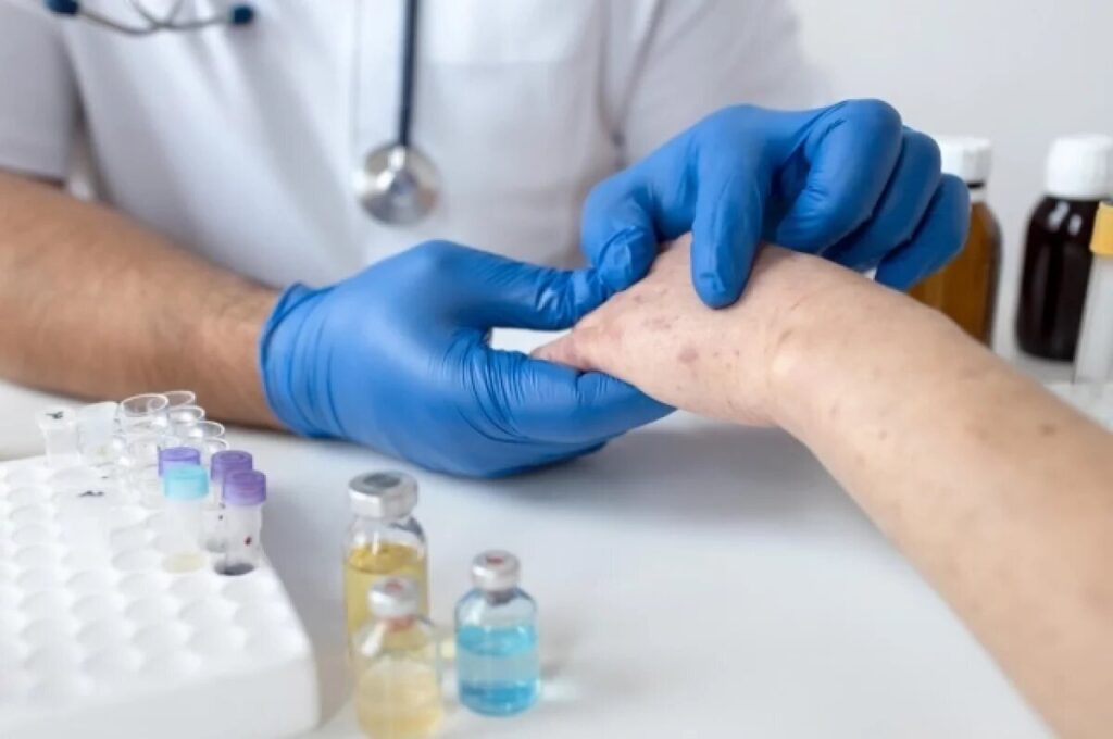 Psoriatic Arthritis (PsA) Treatment Market