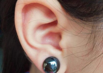 Bio-Magnetic Ear Stickers Market