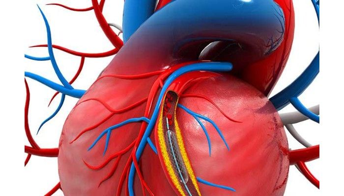 Cardiovascular Needle Market