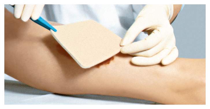 Anti-Biofilm Wound Dressing Market