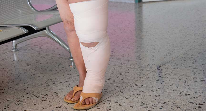 Filariasis Treatment Market