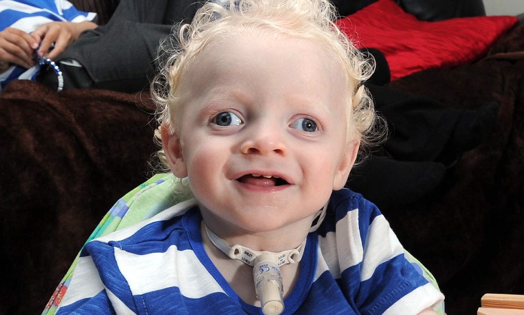 Kounis Syndrome Market