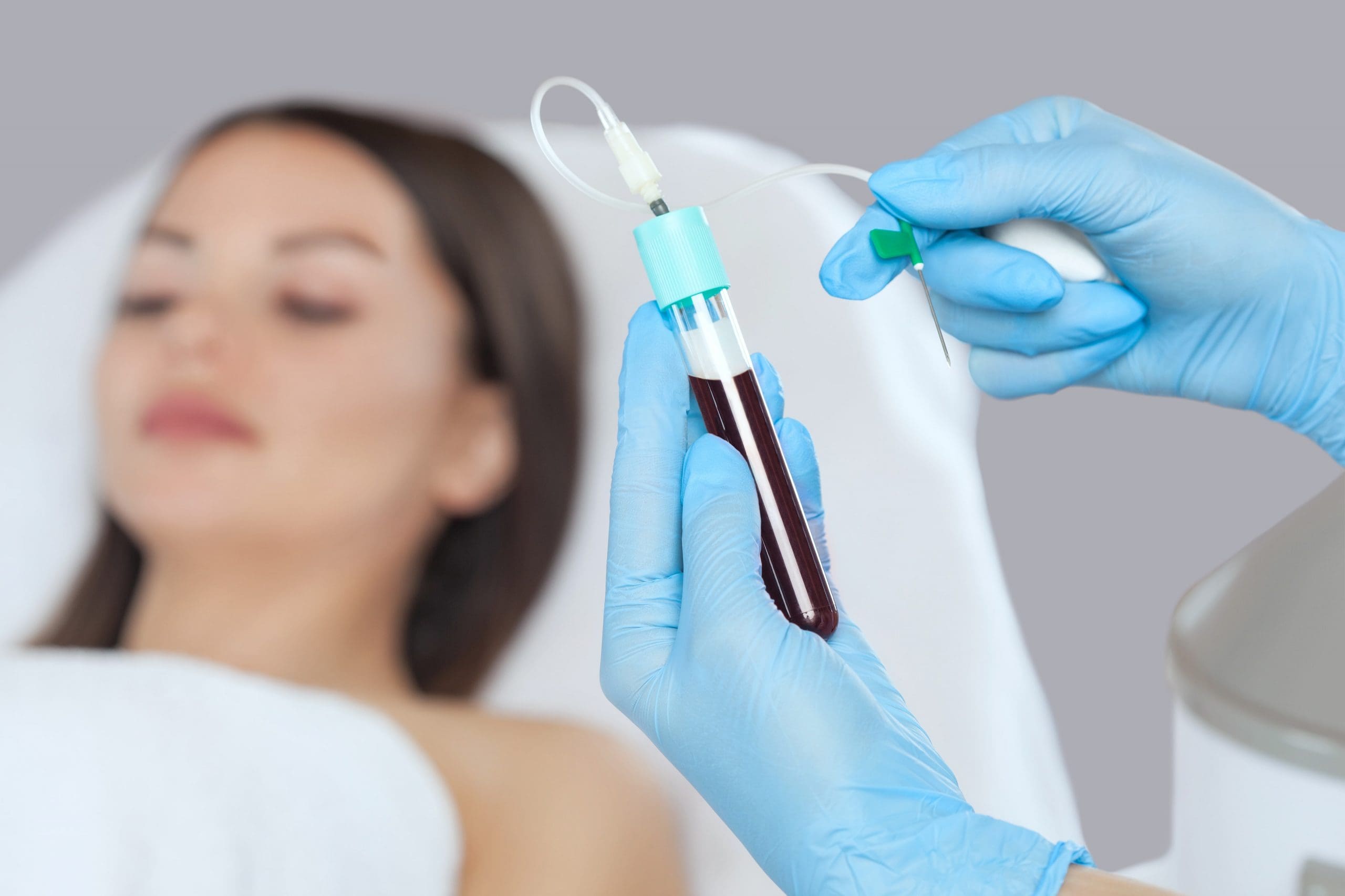 Europe Platelet Rich Plasma (PRP) Market