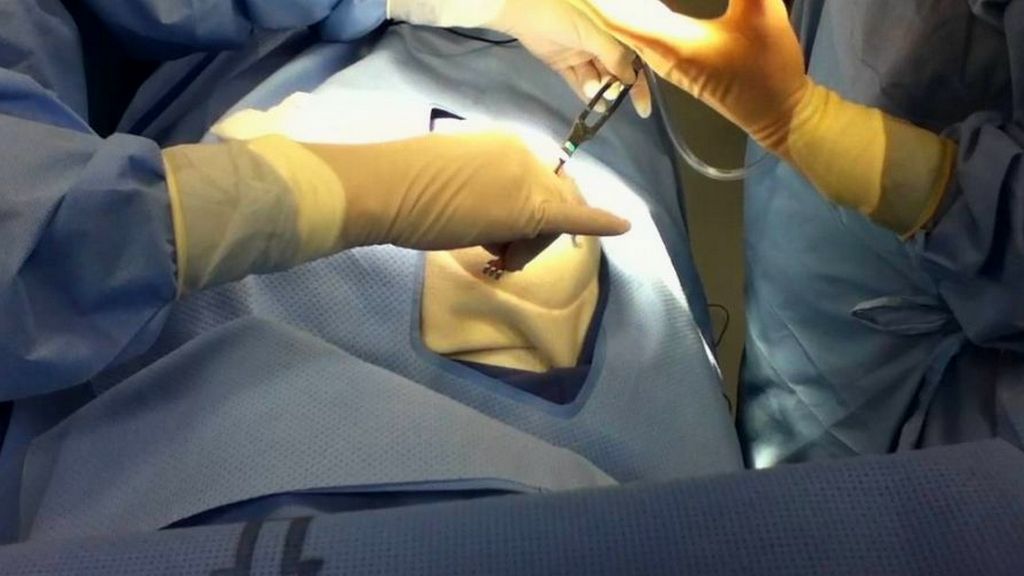 Breast Lesion Localization Devices Market