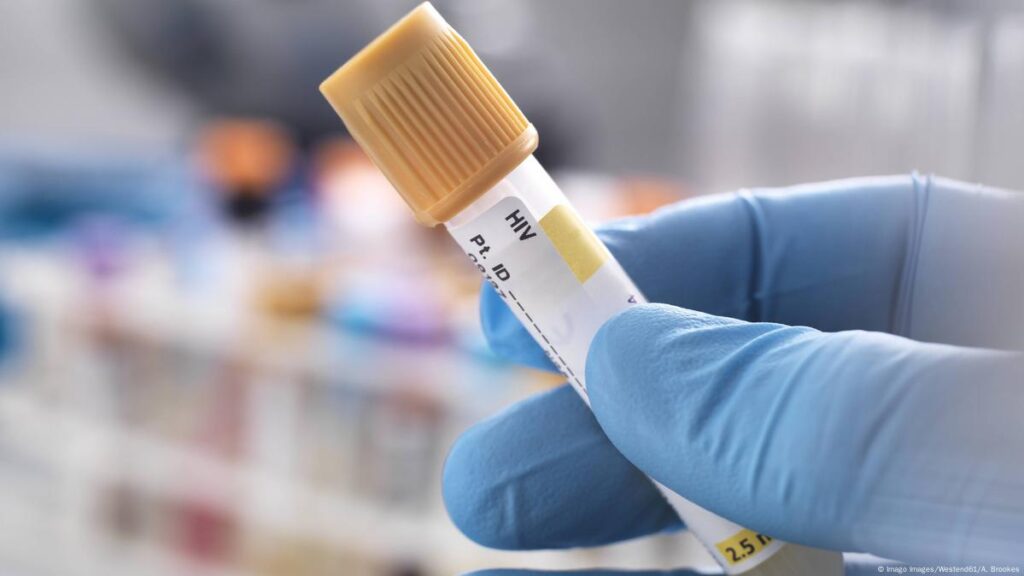 HIV Diagnostics Market