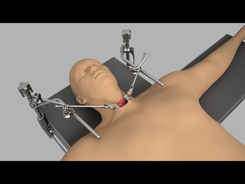 Surgical Snare Market