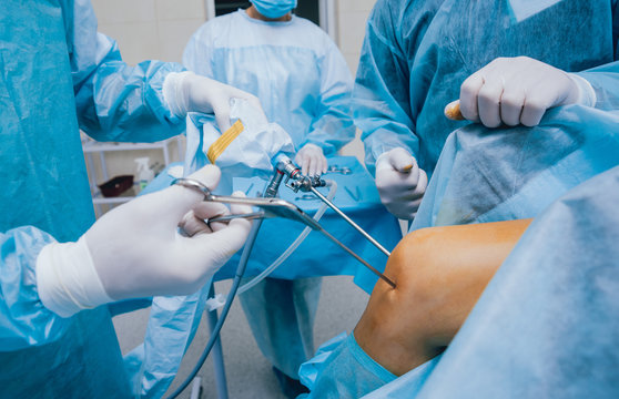 Handheld Arthroscopic Instruments Handheld Arthroscopic Instruments Market Outlook (2023 to 2033)